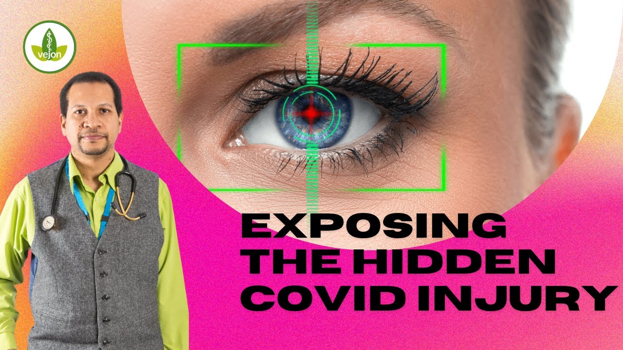 Exposing the Hidden Covid Injury - The Retina of the Eye does not Lie